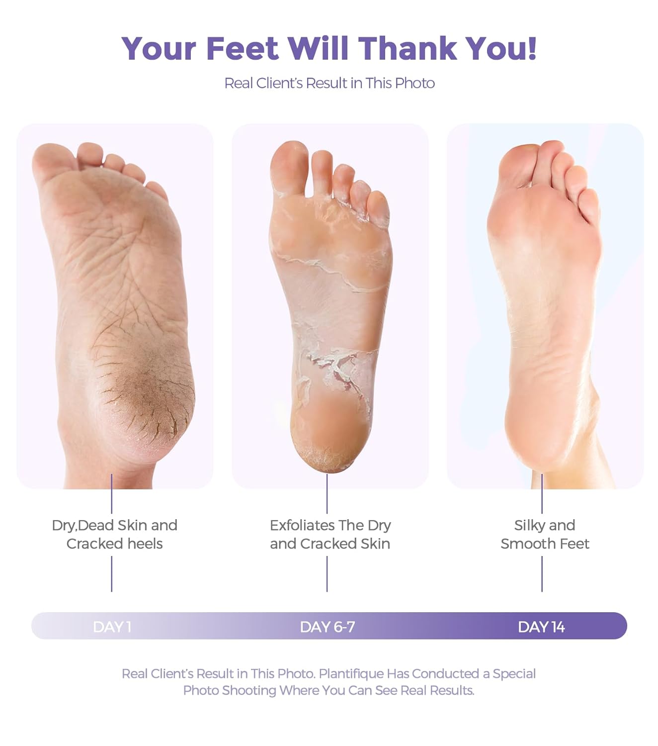 Foot Peel Mask, Lavender Foot Mask Natural Exfoliator for Dry Dead Skin, Callus, Peeling Foot Mask Repairs Heels & Removes Cracked Feet & Rough Heels Enjoy Baby Soft Smooth Feet