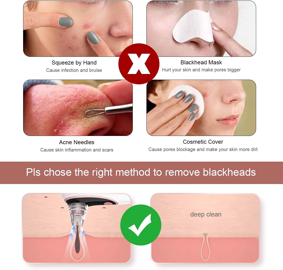 Visible Blackhead Remover Pore Vacuum Electric Camera Pore Cleaner Acne Whitehead Removal Tool Comedone Extractor Face Cleaning Kit with 4 Suction Probes USB Rechargeable